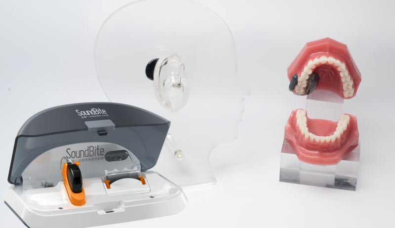 品音&reg;SoundBite&reg;牙骨傳導(dǎo)聽力系統(tǒng)-