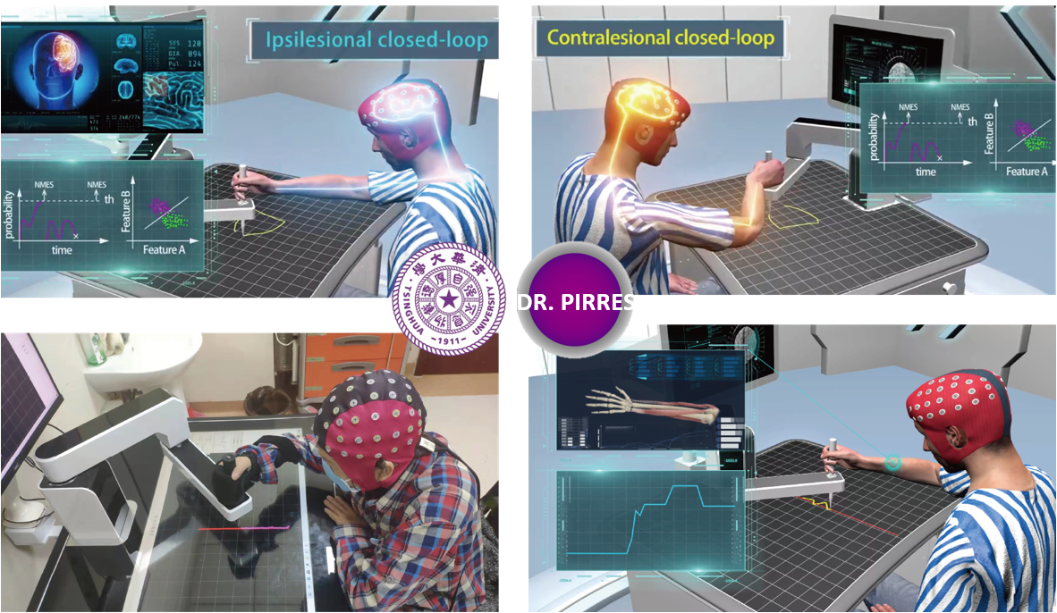 智能精準康復機器人專家系統(tǒng)